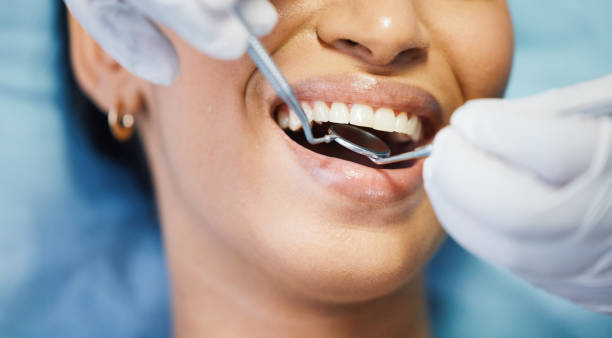 Best Emergency Tooth Extraction in Spurgeon, TN